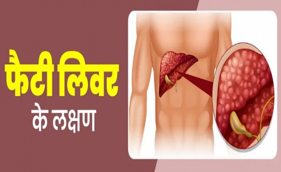 फैटी लिवर की समस्या